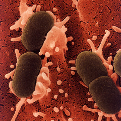 WiB - E.coli